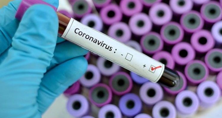 Koronavirüs en çok hangi yüzeylerde bulunur?