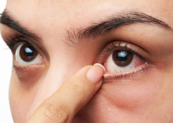 Koornavirüsün yeni belirtisi tespit edildi: Konjonktivit