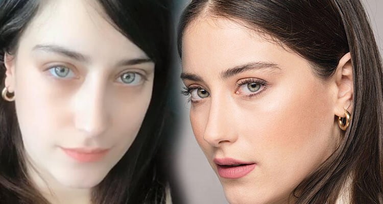 Hazal Kaya: Gözlerimin altı mor değil, çürük artık...