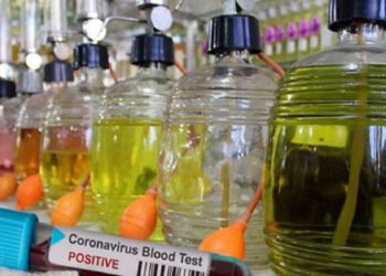 Koronavirüs tedbirleri! Kolonya ve dezenfektan üretimi artacak