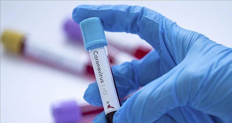 O ülkede koronavirüsten ilk ölü