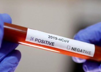 Koronavirüs nedeniyle 2 Türk hayatını kaybetti