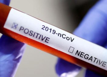 Türkiye'de 'korona'dan ölü sayısı 37'ye yükseldi