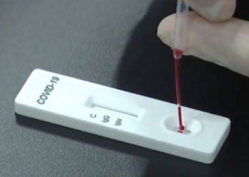 5 dakikada sonuç veren koronavirüs kiti