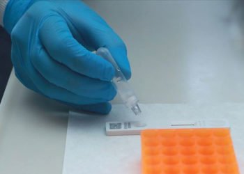 Türkiye'de 73 merkez 'Kovid-19 Tanı Laboratuvarı'