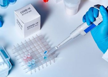 Olacak iş değil! İstanbul'da 1250 TL'ye korona testi