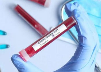 Uyarıları dinlemiyorlar, ücretli korona testi yapıyorlar