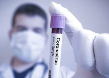 Sağlık Bakanlığı'ndan online korona testi!