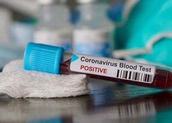 Türkiye'de koronavirüs testi paralı mı?