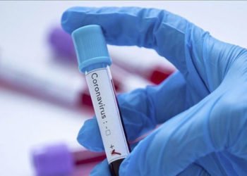 O ülkede koronavirüsten ilk ölü