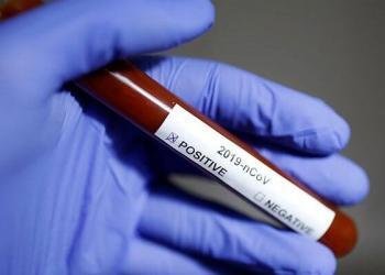 Koronavirüse karşı geliştirilen bitkisel ilaç bugün tanıtılacak