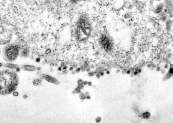 Koronavirüsün hücreyi enfekte etmeye çalıştığı an görüntülendi