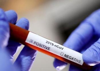 Koronavirüs neden erkekleri daha çok etkiliyor?