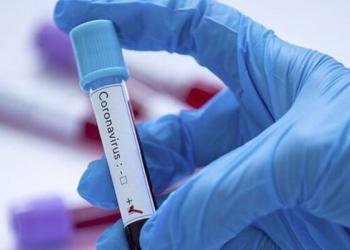 Koronavirüs tedavisi ücretsiz oldu