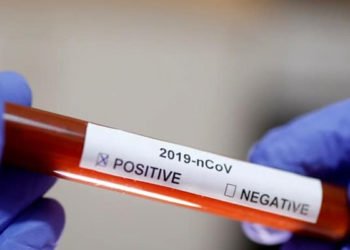 İngiltere’de dört saatte sonuç veren test geliştirildi