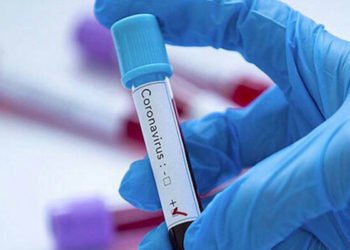 2 dakikada sonuç veren korona testine onay