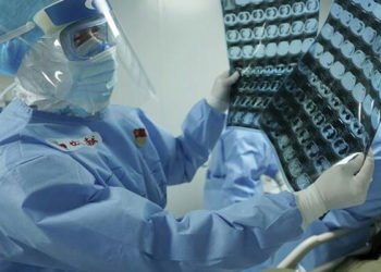 Koronavirüs o organa da zarar veriyor