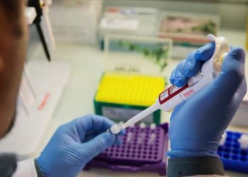 Tanı kitlerinin ithalatında ‘uygunluk yazısı’ şartı