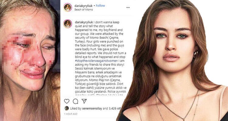 Çeşme'de top model Daria Kyryliuk'e plajda dayak! 