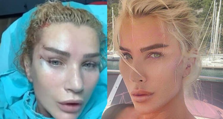 Seda Sayan'dan estetik operasyonu sonrası ilk paylaşım geldi!